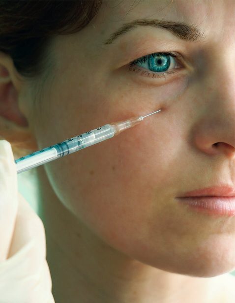 Dermal fillers Tear Trough